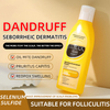 Selenium Sulfide Dandruff Removing Shampoo ( Refreshing and Anti-dandruff )